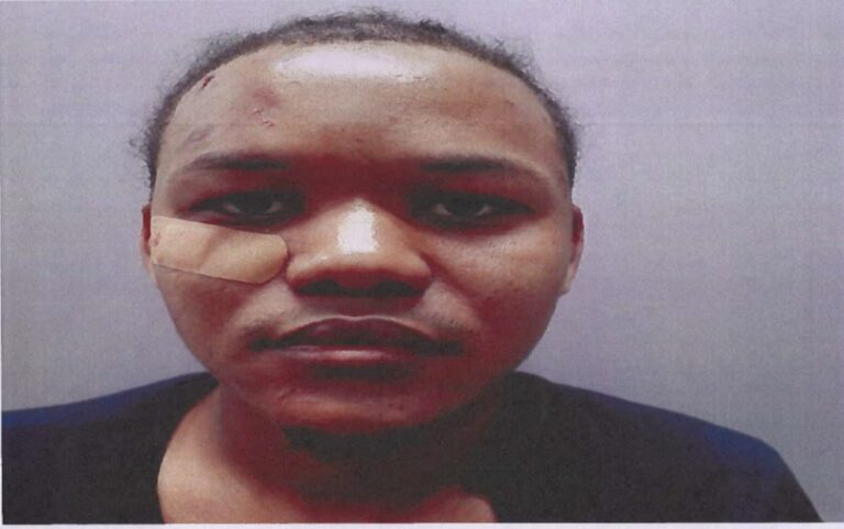 DELFI CHANEL RODRIGUEZ DE LEON - STT